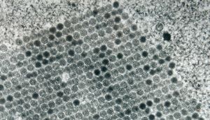 adenovirus in tissue culture - paracrystalline formation adenovirus in tissue culture - paracrystalline formation